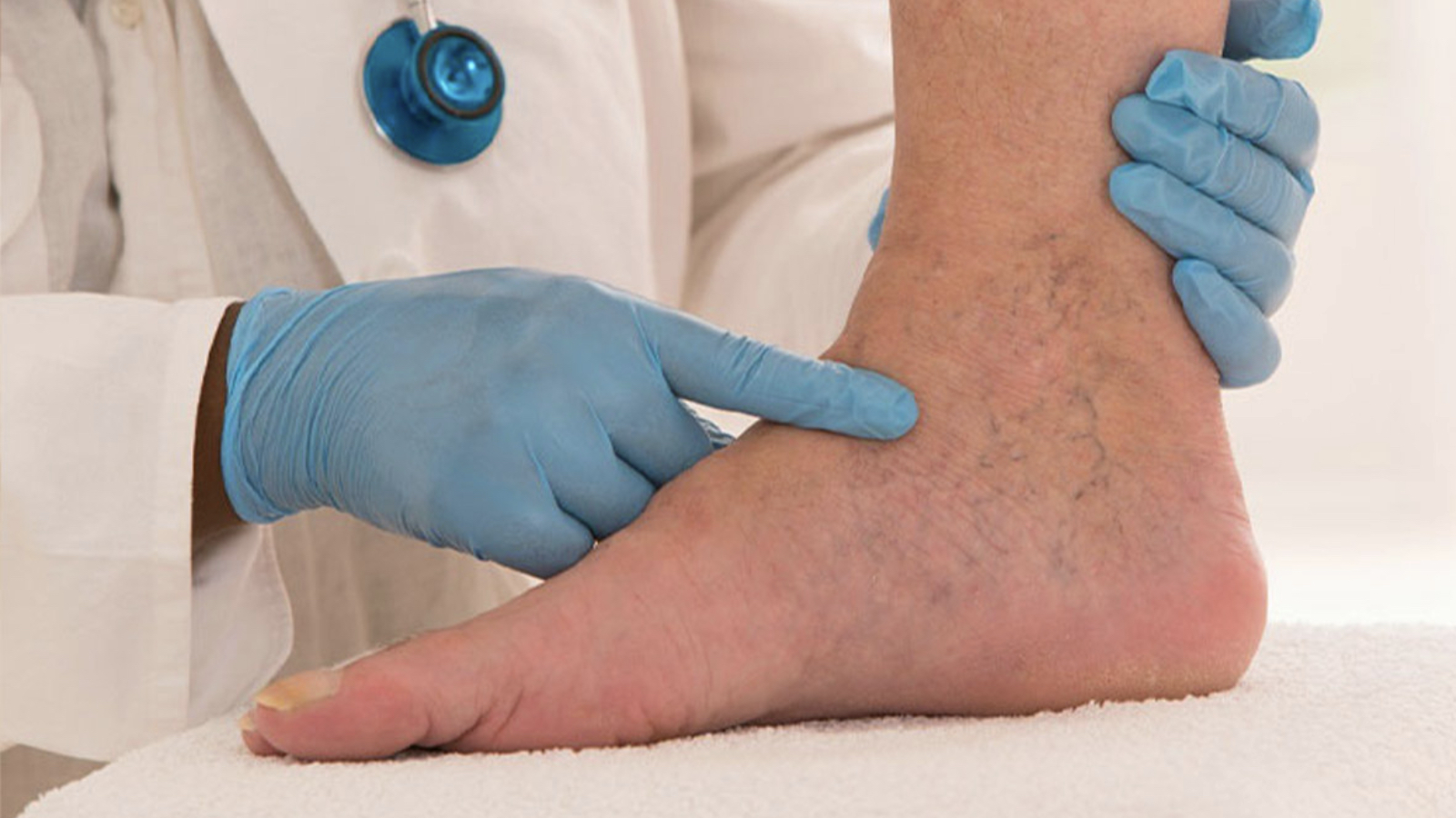 bacakta sislik ve agri hissedenler dikkat derin ven trombozunun isaretcisi olabilir pLqZfuRd