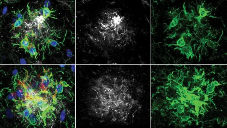 alzheimer-tedavisinde-yeni-ufuk-beynin-temizlik-ekibi-yeniden-programlandi-4qd9XFFb
